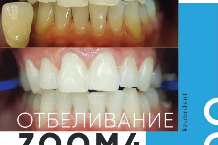 Клиника стоматологии Зубр фото 4